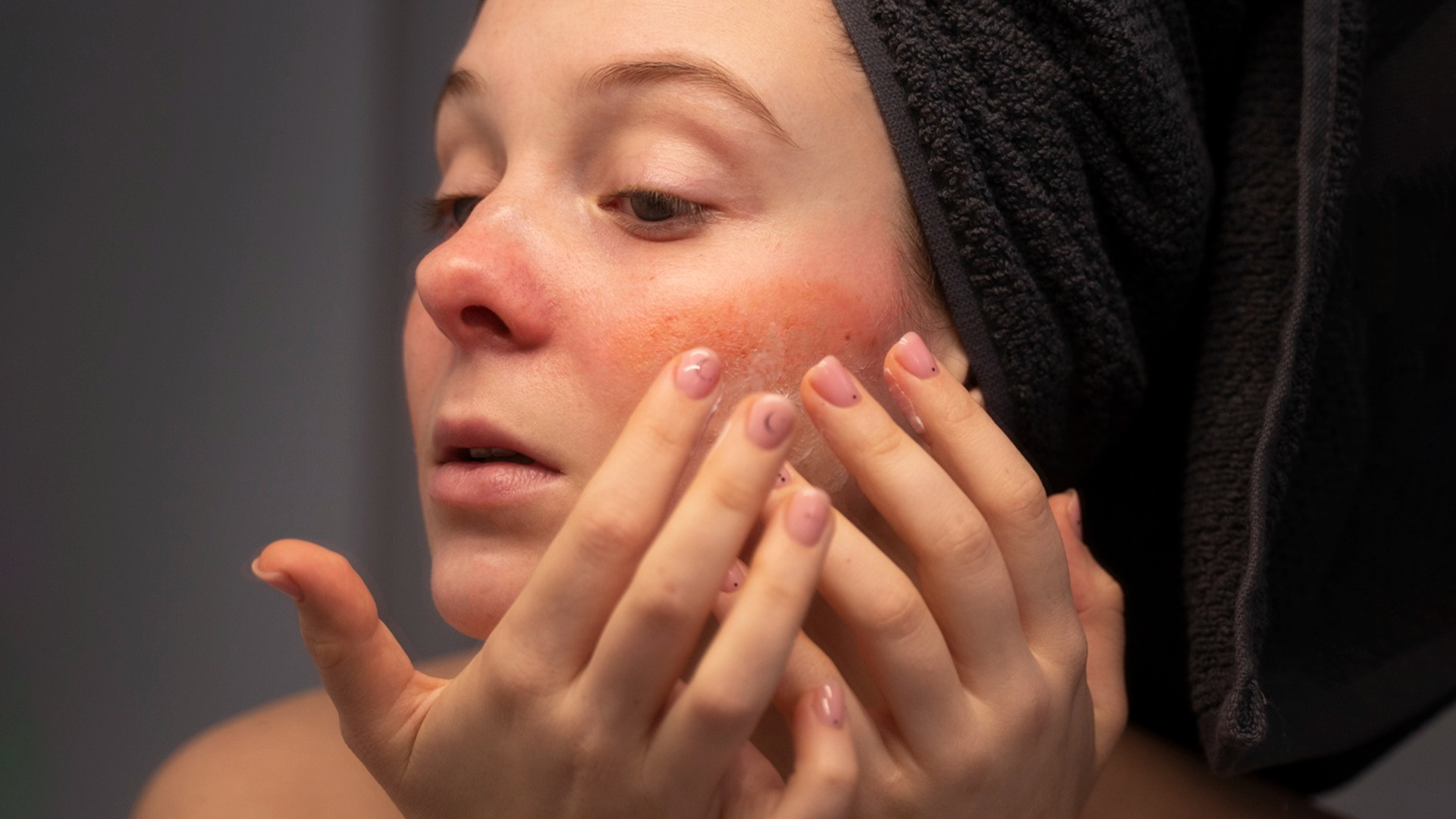 Kulit kamu sensitif? Cek Tips Memilih Skincare untuk Kulit Sensitif Berikut!