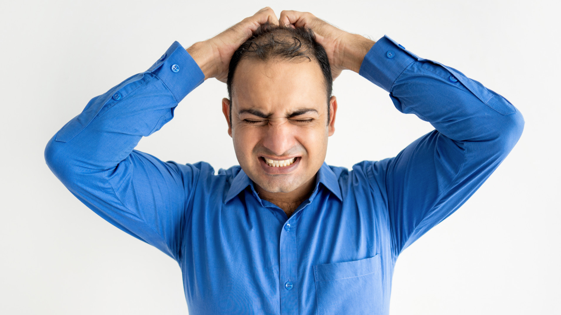 Rambut Mulai Menipis? Ini Tips Mengatasi Kebotakan pada Pria Sejak Dini